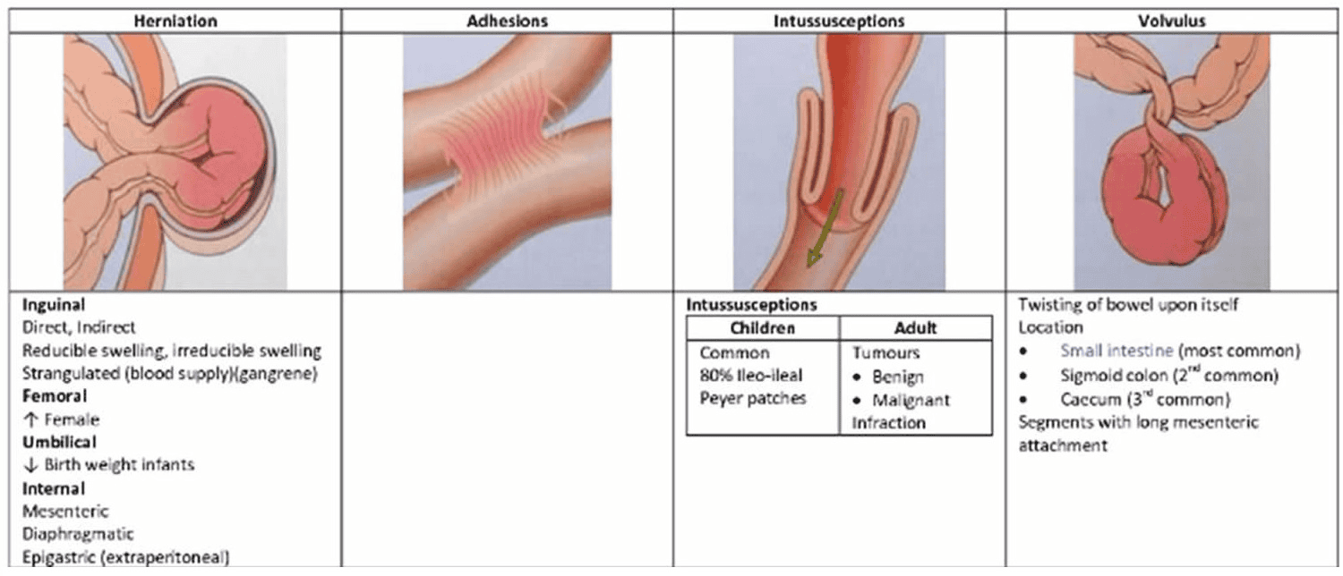 intestinal obstruction